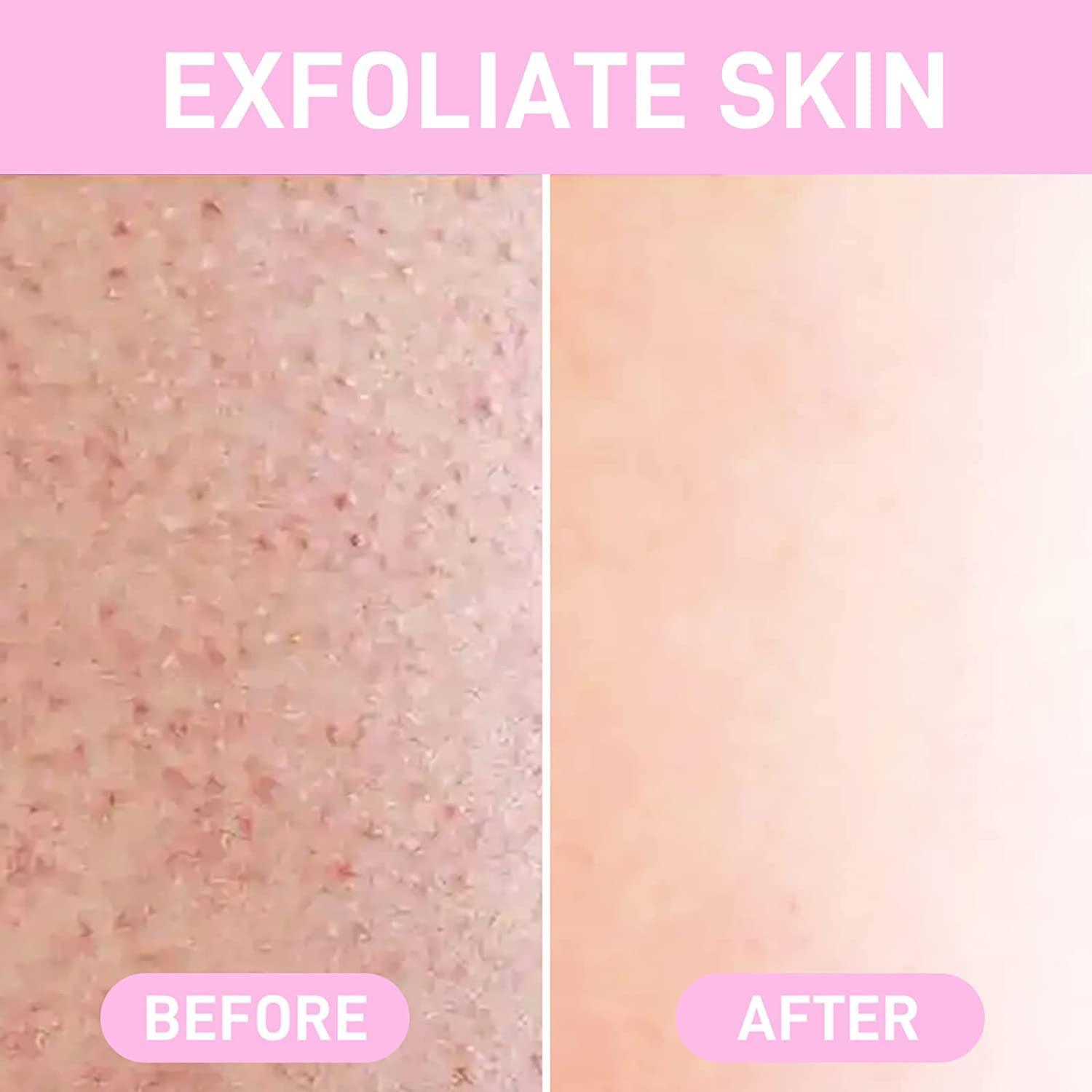 hair removal Crystal - 100% Original - Rumaisas