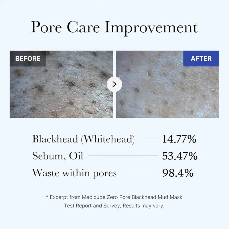 Medicube Zero Pore Blackhead Mud Mask - 100g - Free Applicator - Rumaisas