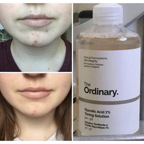 The Ordinary Glycolic Acid 7% Toning Solution - 240ml - Rumaisas