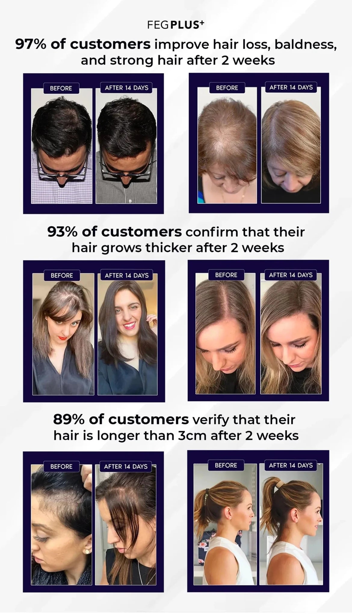 FEG Plus Hair Growth Spray - Rumaisas