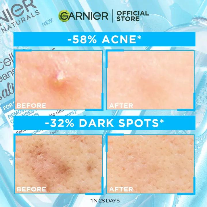Garnier Bright Complete Anti - Acne Cleansing Foam - 100ml. - Rumaisas