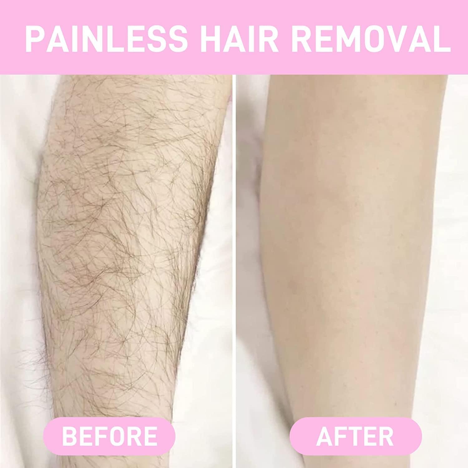 hair removal Crystal - 100% Original - Rumaisas