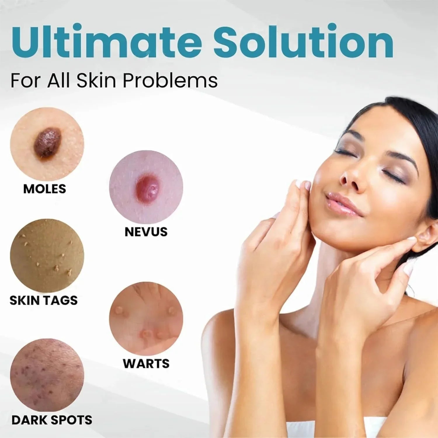 Non - Invasive Mole and Wart Removal Pen - Rumaisas